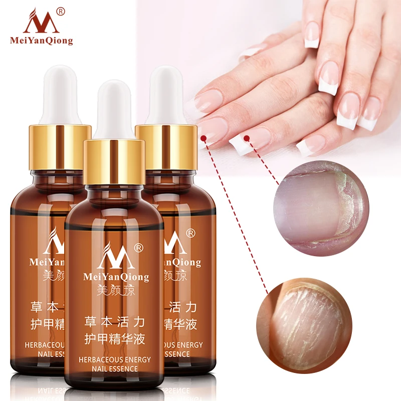 

Nail Fungus Treatment Essence Gel For feet Anti Onychomycosis Fungus Remedy Cream From Nail Fungus Fungal Nail Treatment Serum