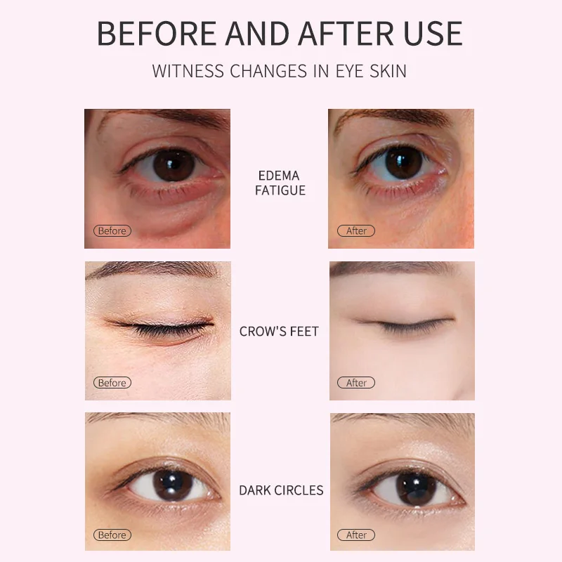 

MSLAM Sakura Moisturzing Eye Mask Anti Wrinkles Remove Dark Circles Moisturizing Eye Patches Reducing Eyes Fine Lines Skin Care