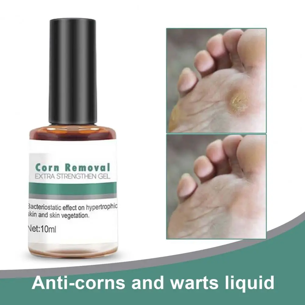 

10ML Useful Corn Removal Treatment Natural Compact Easy to Use Wart Remover Extra Strengthen Gel for Personal External Use