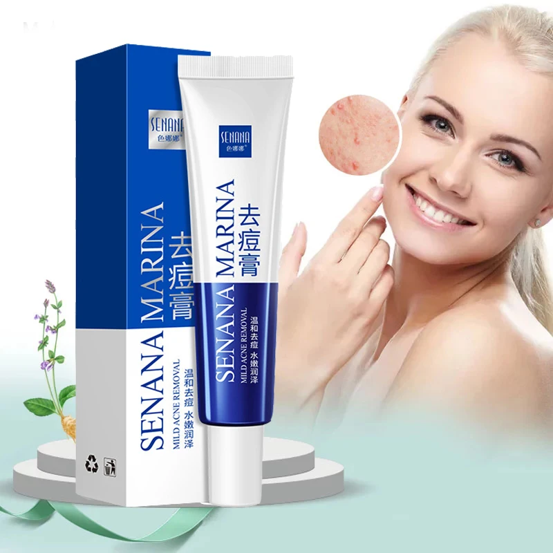 

Moisturizing Moisturizing Oil Control Moisturizing Aloe Acne Cream Moisturizing Acne Mild Acne Cream Acne Treatment