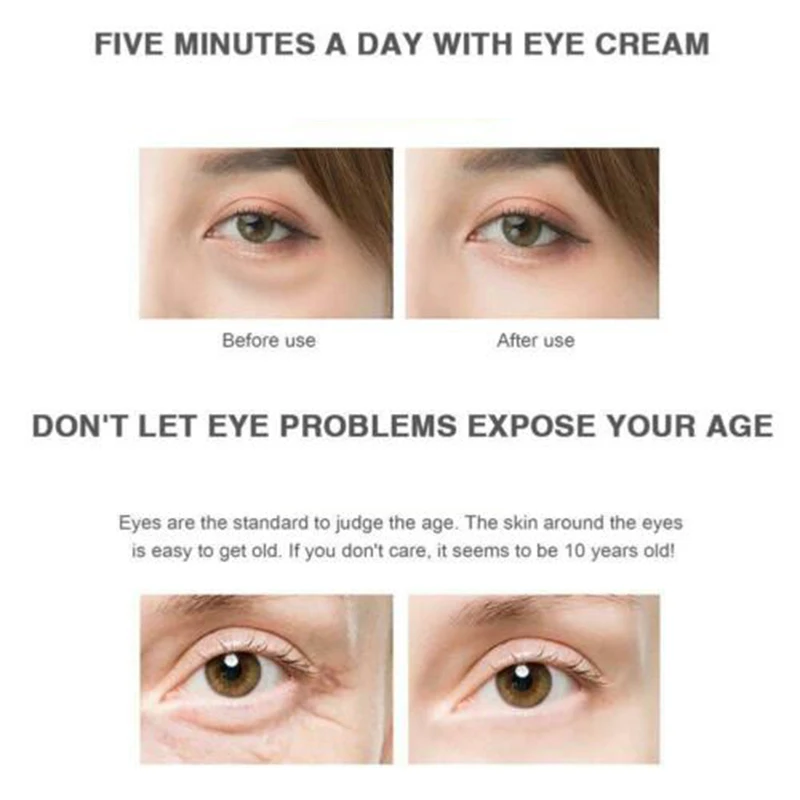 

Cooling Massager Wand with Alloy Roller Tighten Pores Under-Eye Relief Reduce Wrinkle Multi-Use Convenient for Women BUTT666