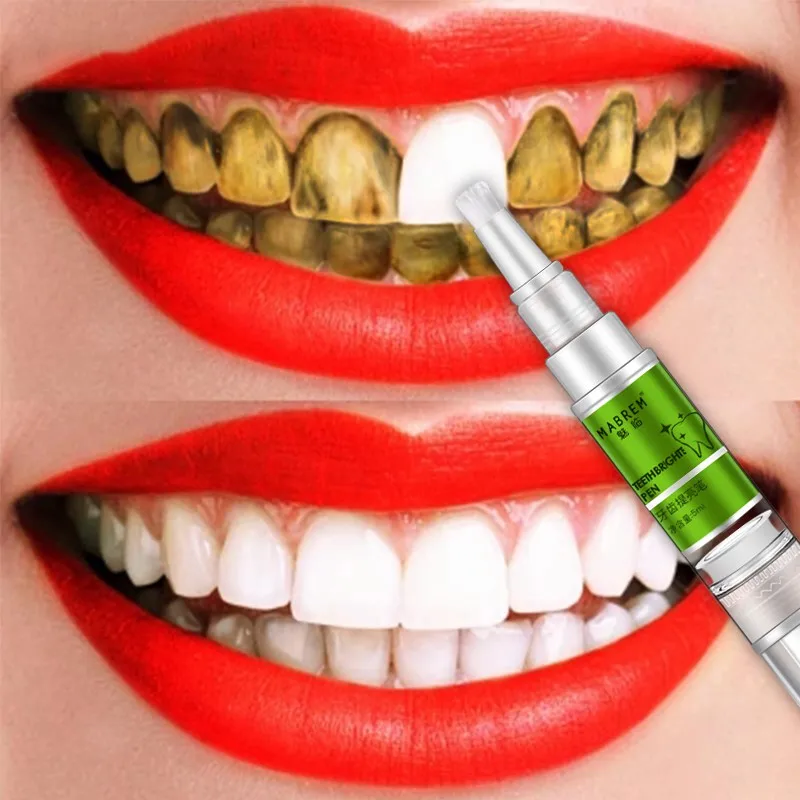 Magic Teeth Whitening Pen Removing Yellow Tooth Cleaning Dazzling White Smile | Красота и здоровье