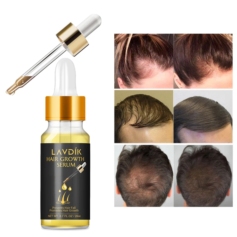 Уход за волосами Эфирное масло для роста волос экстракт имбиря унисекс против