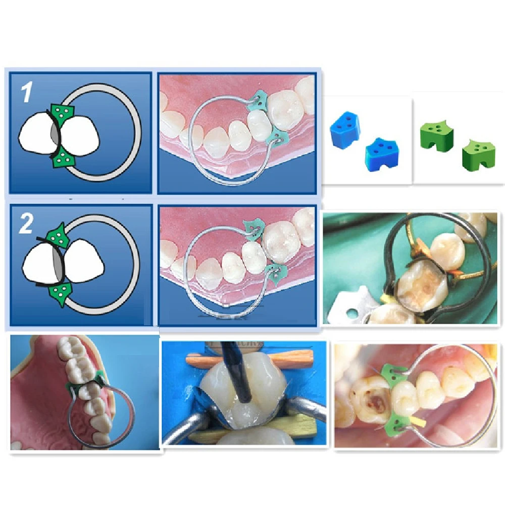 100 шт. Azdent ental секционные Контурные Матричные матрицы 40 силиконовые