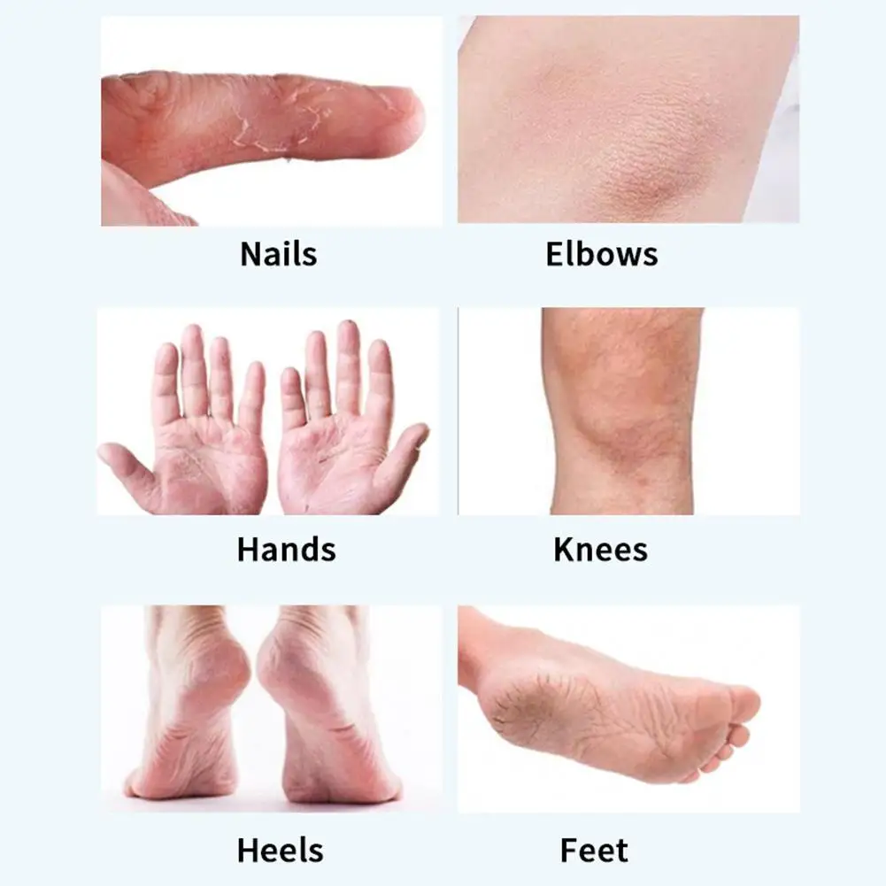 

Lanthome Cleft Foot Urea Cream Moisturizing And Moisturizing Care Foot 50Ml E8D0