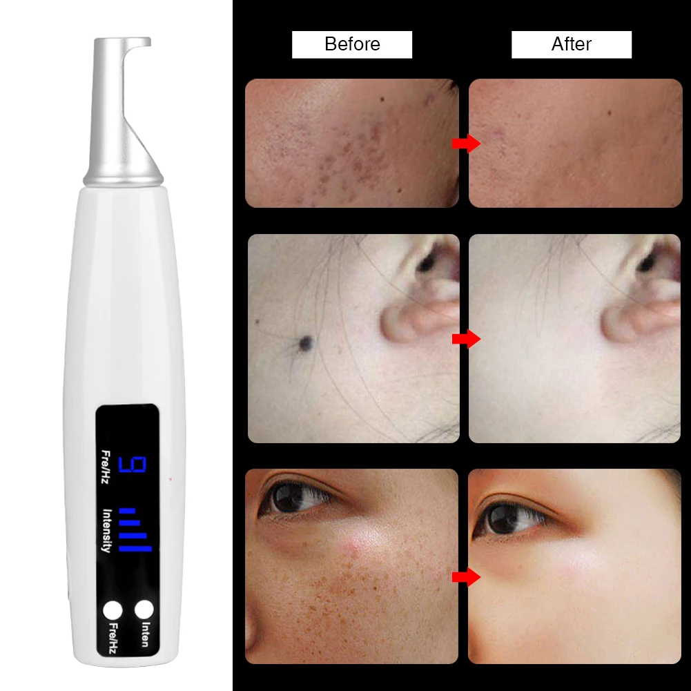 

Machine Mole Removal Safe Tattoo Scar Pigment Light Therapy Professional Skin Care USB Rechargeable Picosecond Pen Freckle