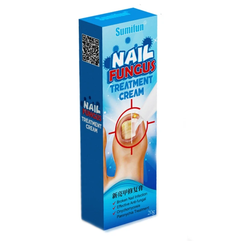 

20g Chinese Herbal Toe Nail Fungus Treatment Cream Onychomycosis Paronychia Anti