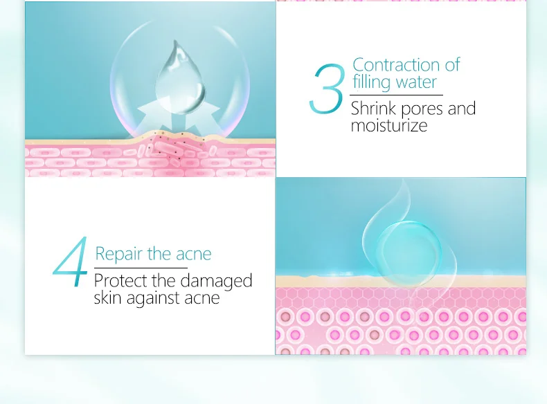 WXE Успокаивающий Крем для восстановления акне Удаление меланина лечение крем