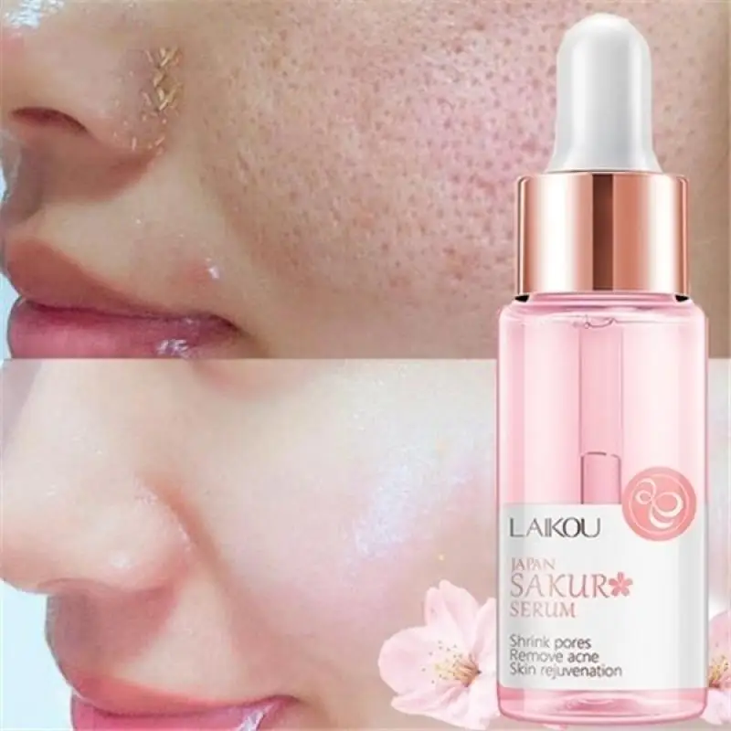 15 мл средство для удаления черных точек с гиалуроновой кислотой глубокое