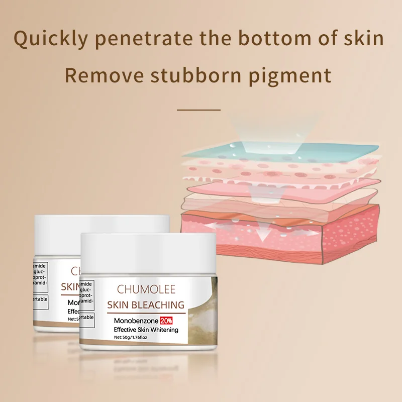 

Chumolee Dark Knuckles Remover Eraser Monobenzone Whitening Cream Bleaching Clear Knuckles Cream for Vitiligo Hands Fingers Feet