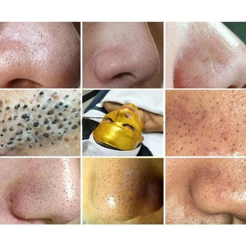 

1pcs Gold Tearing Nasal Mask Fading Fine Lines Whitening Moisturizing Shrinking Pore Mask Anti Pore Shrinking Mask