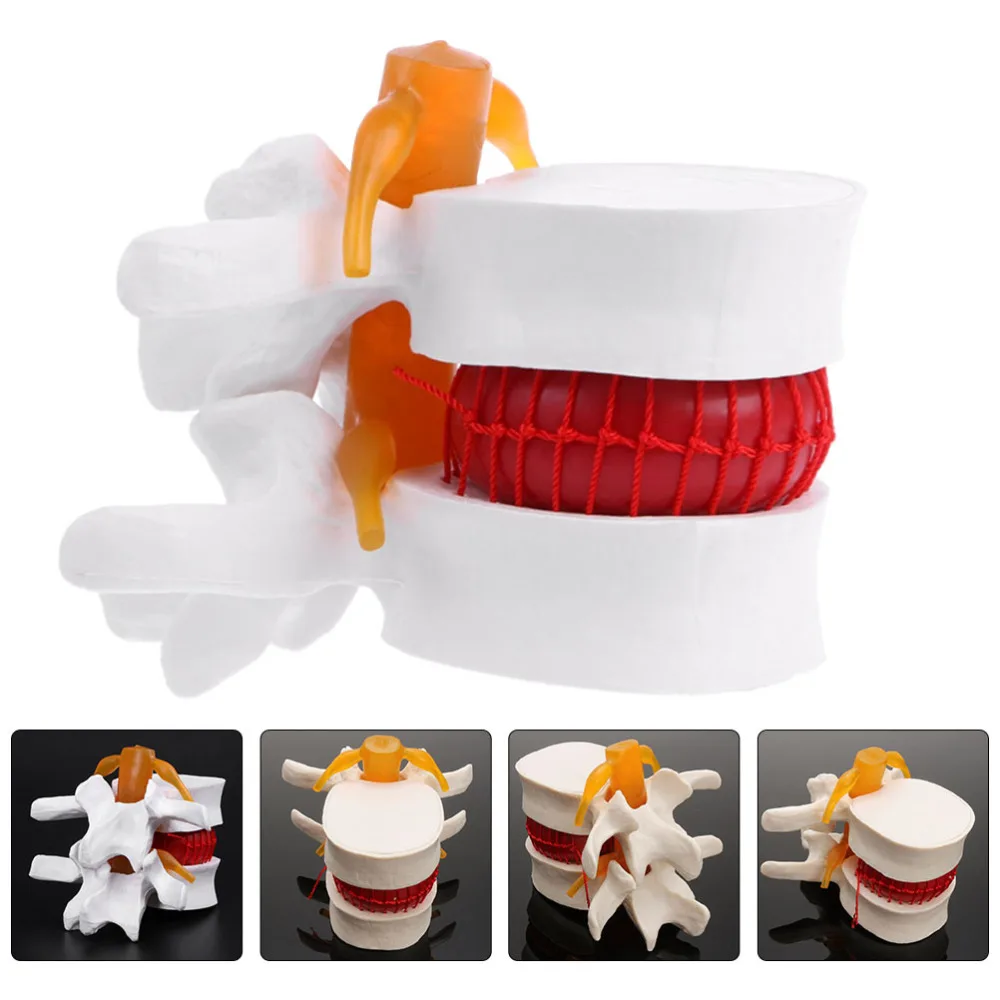

1pc Human Spine Model Lumbar Disc Herniation Presentation Model for School