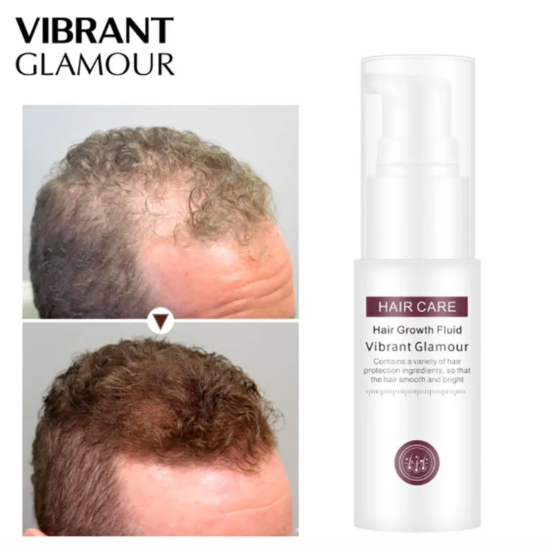 

Hair Growth Grow SÃ©rum Spray Aceites Esenciales Perte Pousse Des Cheveux Produit Tratamientos Capilares Crescita Capelli Beleza