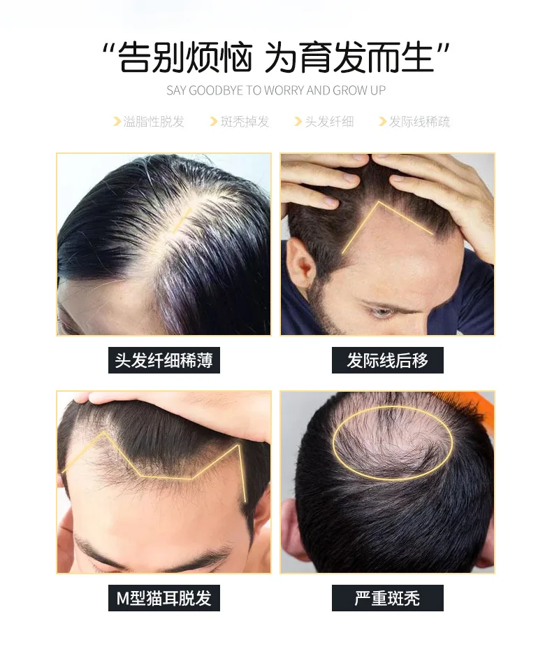 2 упаковки/партия жидкий лосьон для роста волос против облысения|Средства от