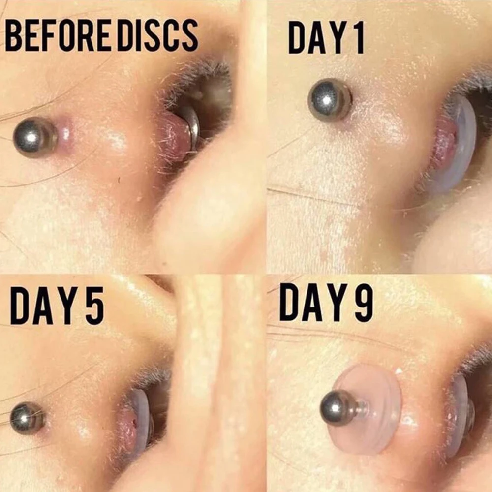 30 комплектов/партия силиконовый пирсинг исцеления диски гибкий анти гиперплазия