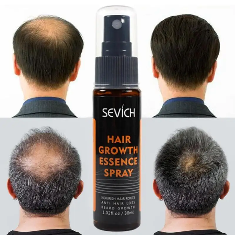 

Sevich 30Ml Plants Essence Hair Growth Spray for Hair Treatment Anti Preventing Hair Loss Product Hair Repair Growing Faster