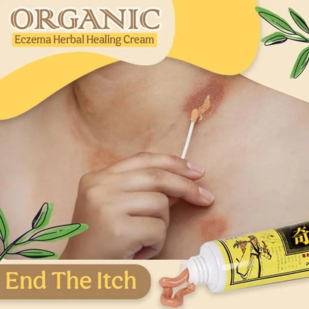 

Antibacteria Antipruritic Cream For Dermatitis Eczema Pruritus Psoriasis Ointment Body Skin Care For Adult Children