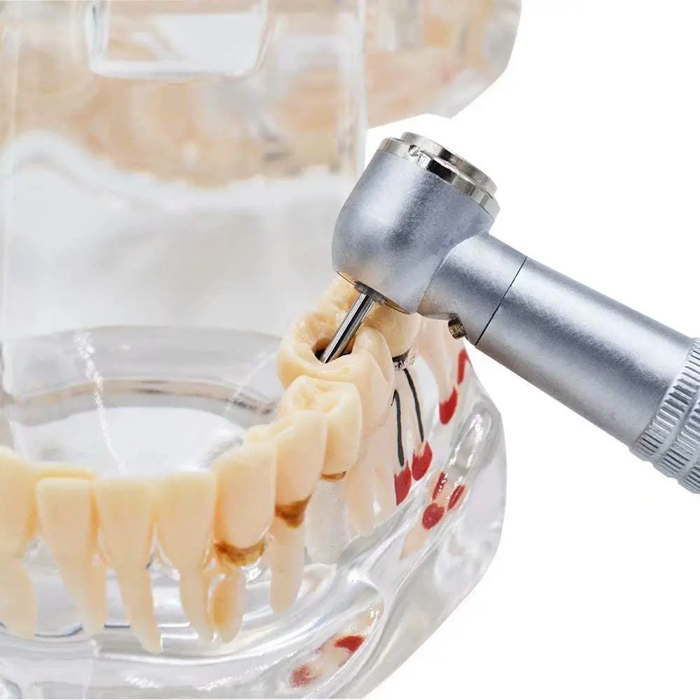 

Dental Handpiece 2H High Velocity Precise Technology Rotation Devices Self Illumination LED Type 10pcs Oral Kit