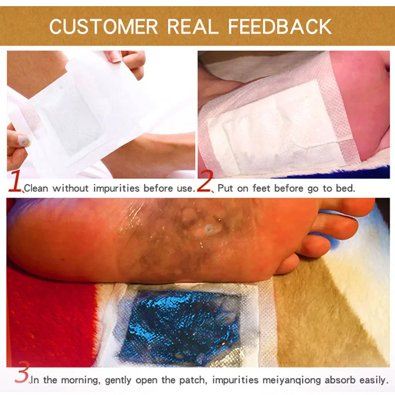 10 шт. пластыри для ног снятия стресса|Инструмент ухода за ступнями| |