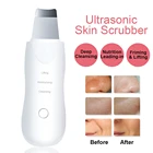 Аппарат для глубокой очистки лица, лопатка для лица, скребок для кожи, ультразвуковой пилинг, ультразвуковое устройство для чистки пор
