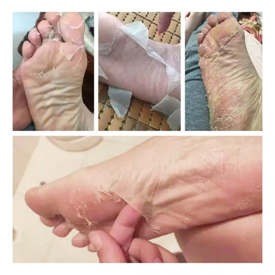 5pcs Moist Foot Exfoliation Removal Moisturizing Mask Dead Skin Care |