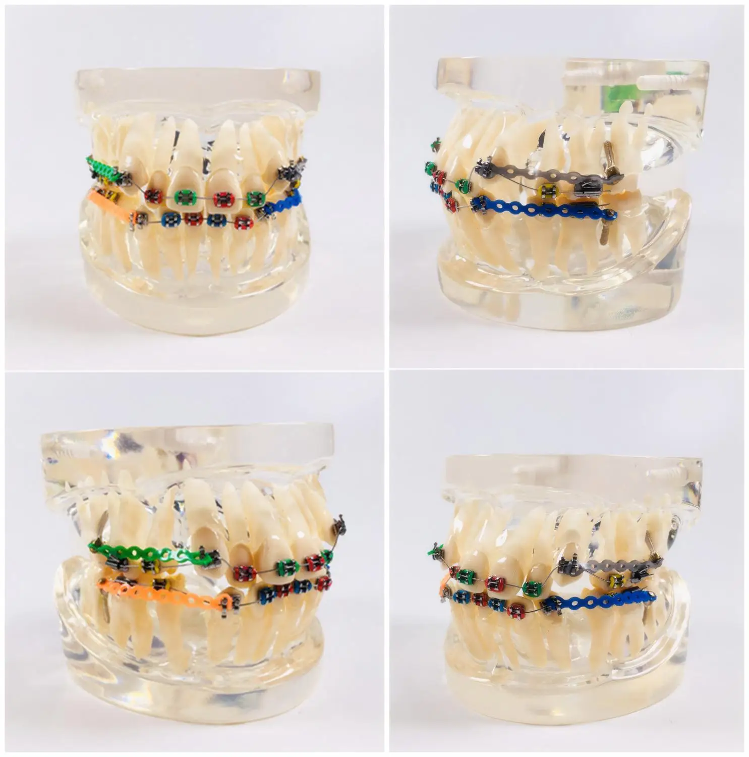 

1 шт. Стоматологическая Ортодонтическая лечебная искусственная цепь