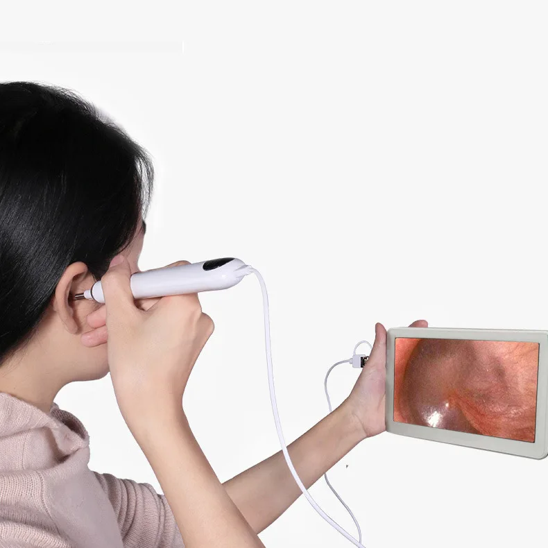 7-дюймовый дисплей 3,9 мм Встроенная отоскоп визуальный Ларингоскоп otolaryngoscope вагинальный эндоскопа Визуальный ухо совок