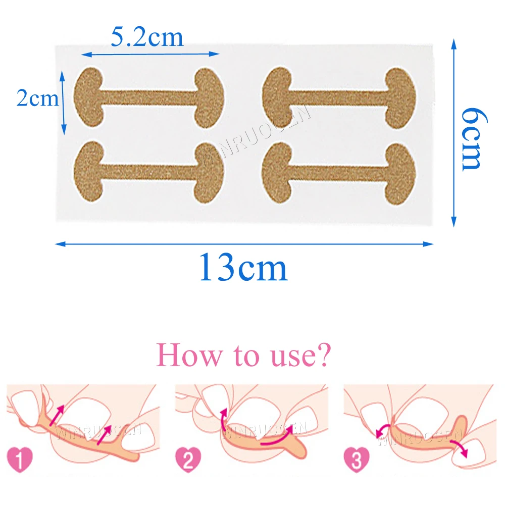 

4pcs Paronychia Ingrown Nail Patch Toenails Correction Recover Care Paronychia File Patch Corrector Foot Pedicure Tool Inserts