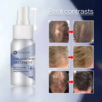 hair rapid growth spray for mens treatment hair loss natural herbal health hair growth longer and thicker hair care products