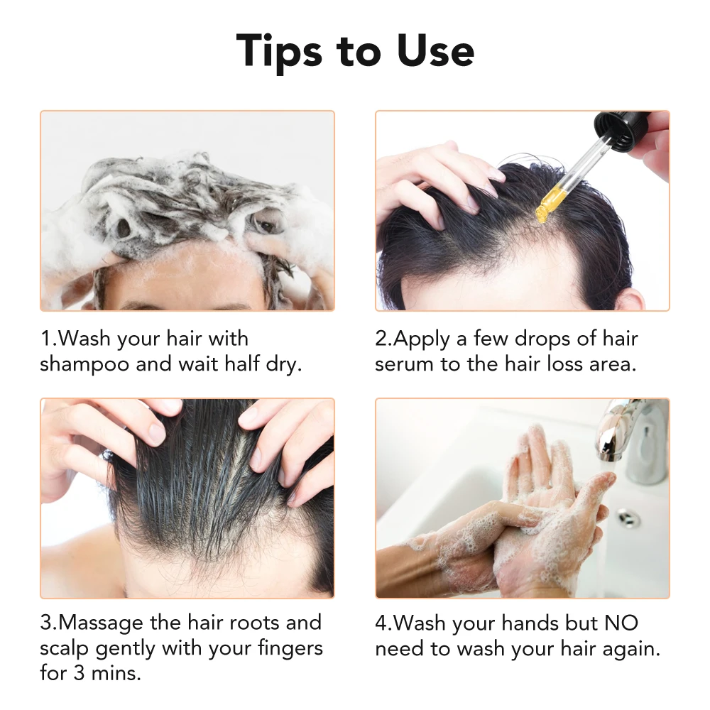 

30ml Ginger Hair Growth Serum Essence 7 Days Germinal Anti Hair Loss Repair Damaged Hair Serum Oil Growing Faster Hair care