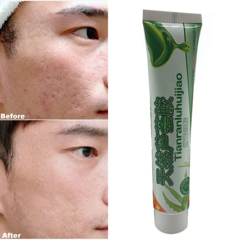 Увлажняющий гель с алоэ вера 30 мл | Красота и здоровье