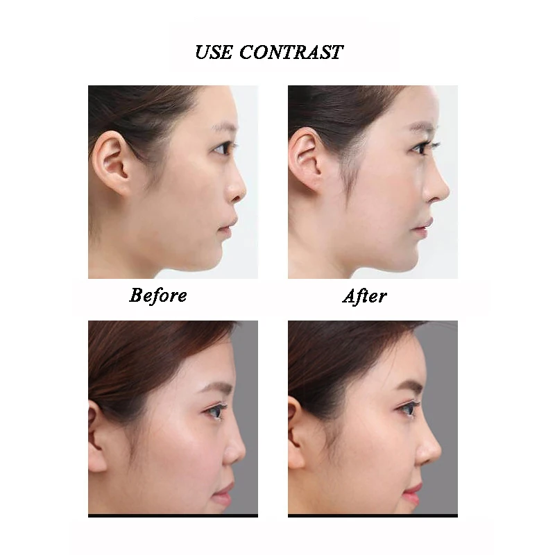 30 мл нос Сыворотки Гиалуроновая кислота Коллагена анти старения морщин лифт для