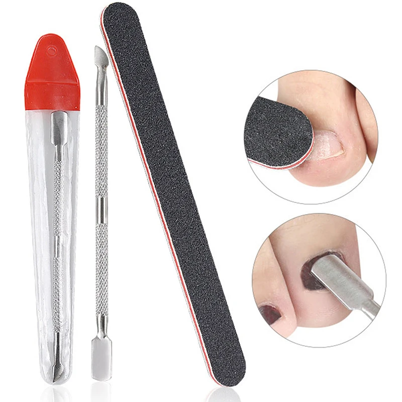 Инструмент из нержавеющей стали для ухода за вросшими ногами | Красота и здоровье