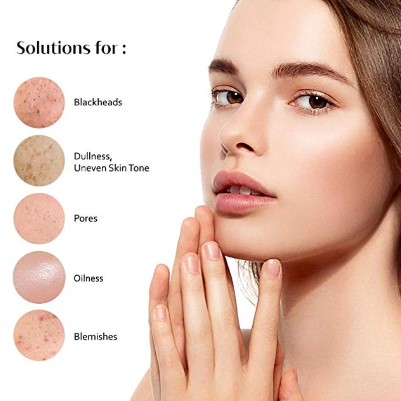 Лидер продаж маска CCPT из вулканической грязи для удаления черных точек глубокое