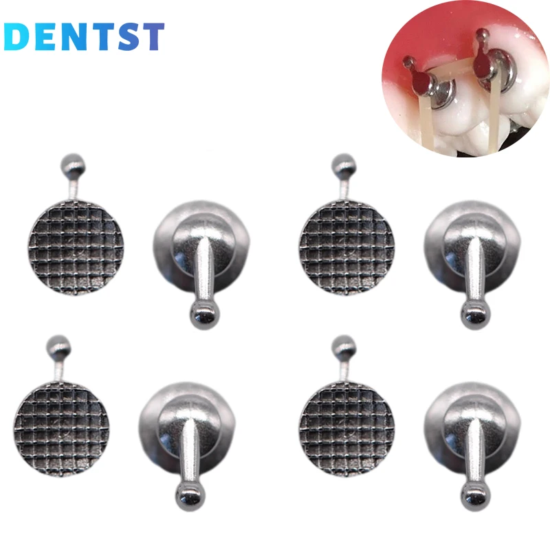 50 шт. ортодонтический прибор для обжима языка| |