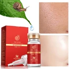 12 мл Высокое качество snail100% эссенция Гиалуроновая кислота Жидкость для отбеливания экстракт против пятен сужение пор ампула против акне регенеративная