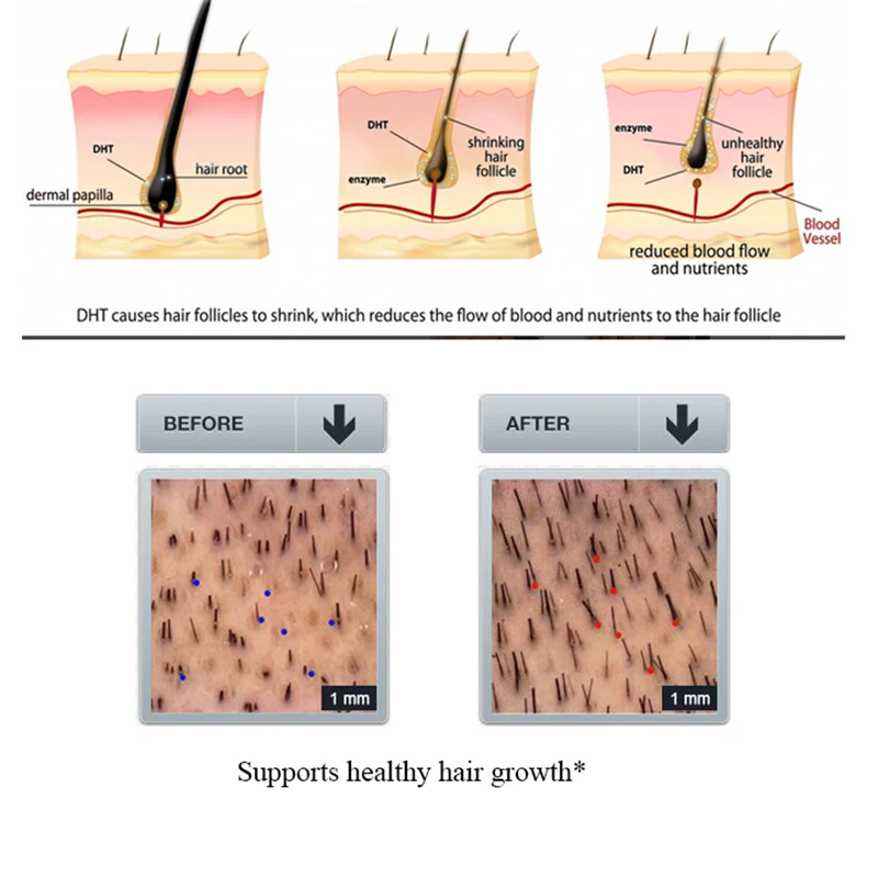 Шампунь для выпадения волос Macadamia набор восстановления и ухода за