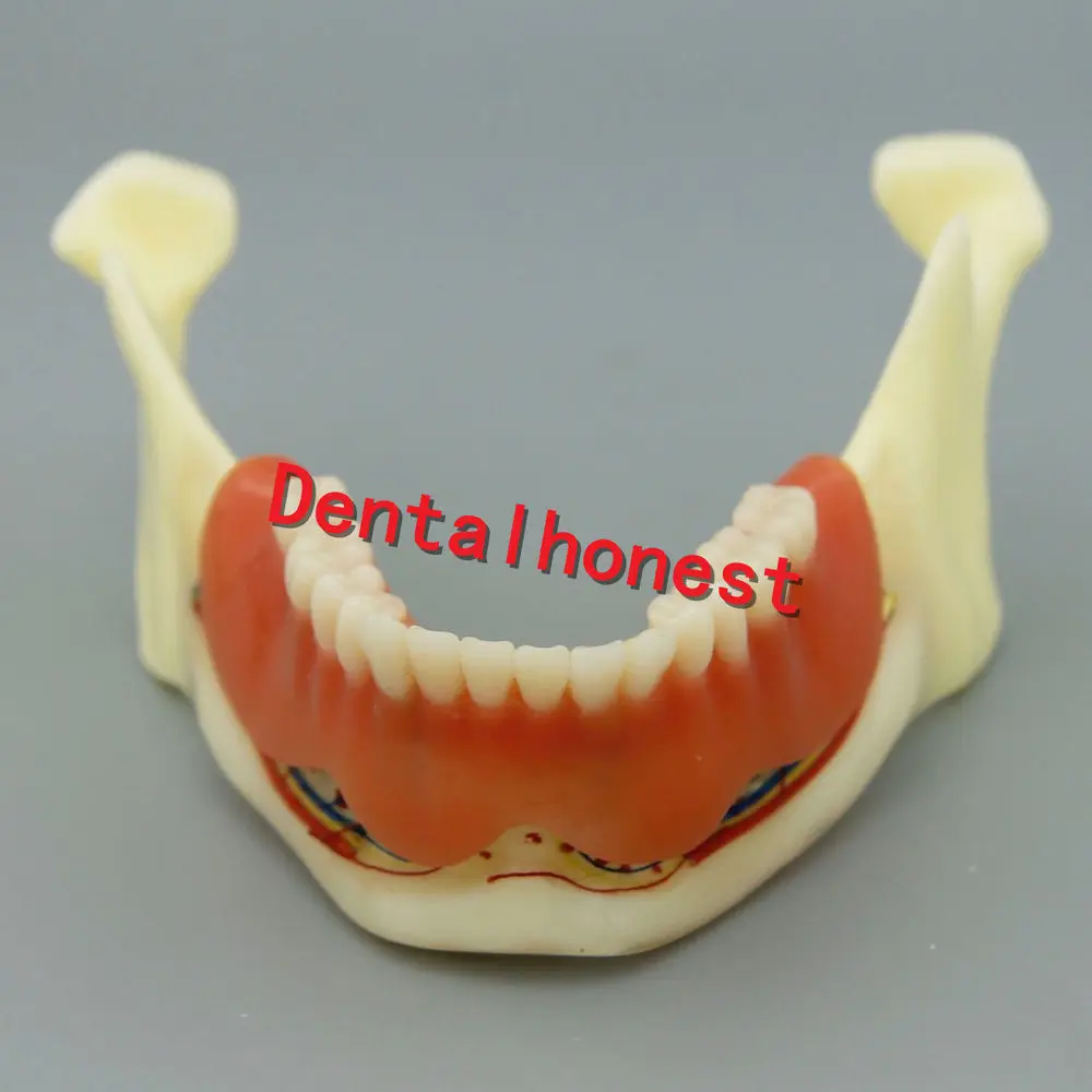 1 шт. Mandible имплантант зубов Модель для стоматологического обучения стоматолога