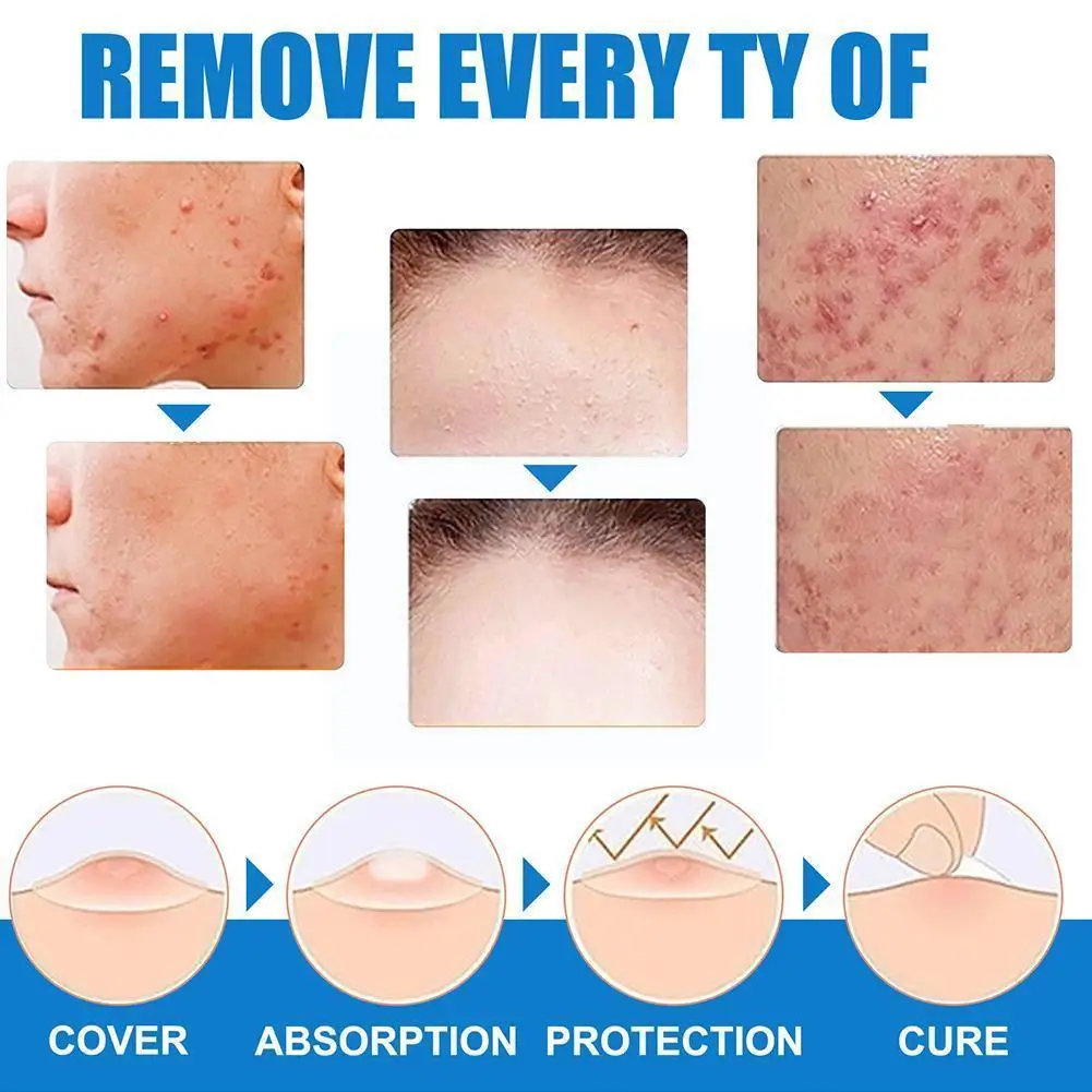 

20ml Wart Remover Cream Ointment Wart Treatment Cream Tag Herbal Skin Extract Care Corn Plaster Ointment Warts Body Remover Y1S3