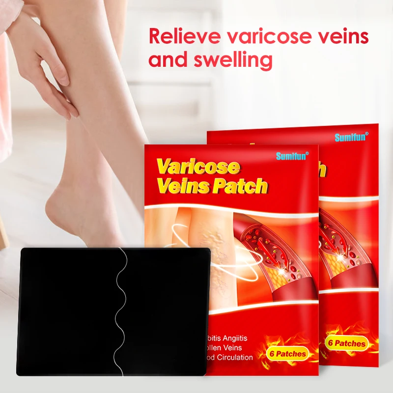 Sumifun 6Pcs Varicose Veins Plaster Treatment Angiitis Spider Leg Vasculitis Phlebitis Care Removal Patch Chinese Herbal Patches | Красота и
