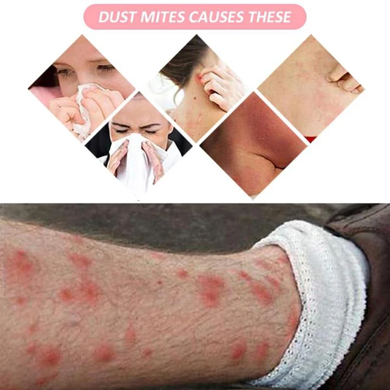 

Anti-mite Pad Mite Removal Killing Pad Flea Removal Mat for Home Hotel Bed SAL99