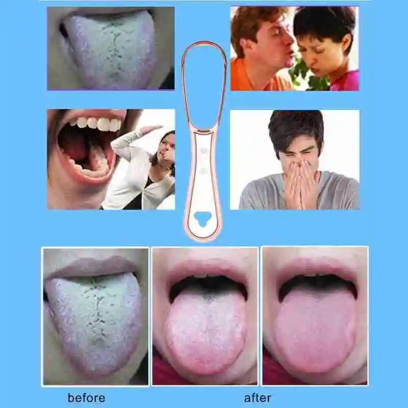 

Tongue Brush Cleaner Silicone Tongue Scraper Reduce Steel Toothbrush Oral Breath Coating Hygiene Remove Bad Oral Cleaning Y6P5