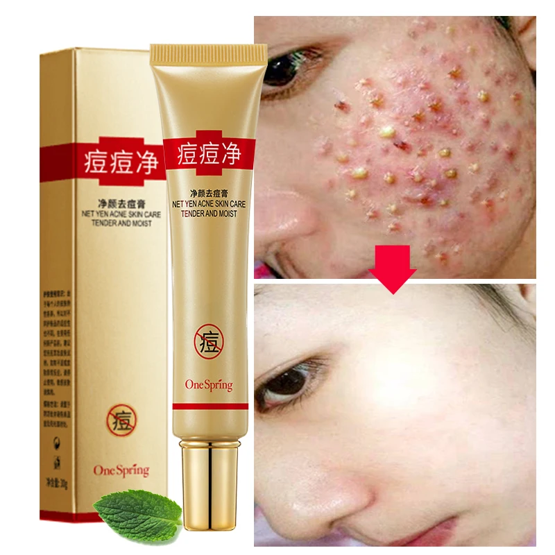 30 г лечение акне очищающий крем для лица против сокращение пор удаление жирной