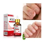 Эссенция для лечения грибковых инфекций у пальцев ног Paronychia, Масло для кутикулы ногтей, все для маникюра и ногтей