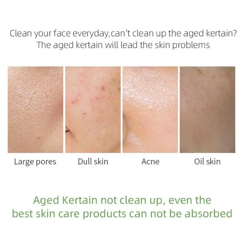 Уход за лицом Кислотный пилинг Гель Эксфолиант Шелушение Красота Глубокий гвоздика Очищающее молочко Удалитель Очищающее средство Кожа.