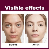 blackhead treatment remove face cream face exfoliating facial cleaner acne whitening cream scrub cream moisturizer gel r3m5