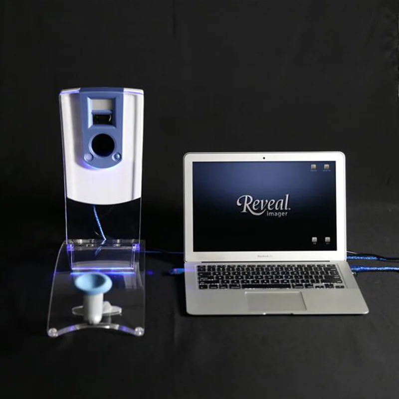 Профессиональный кожи Amalysor лица раскрыть Imager Новый анализа изображений