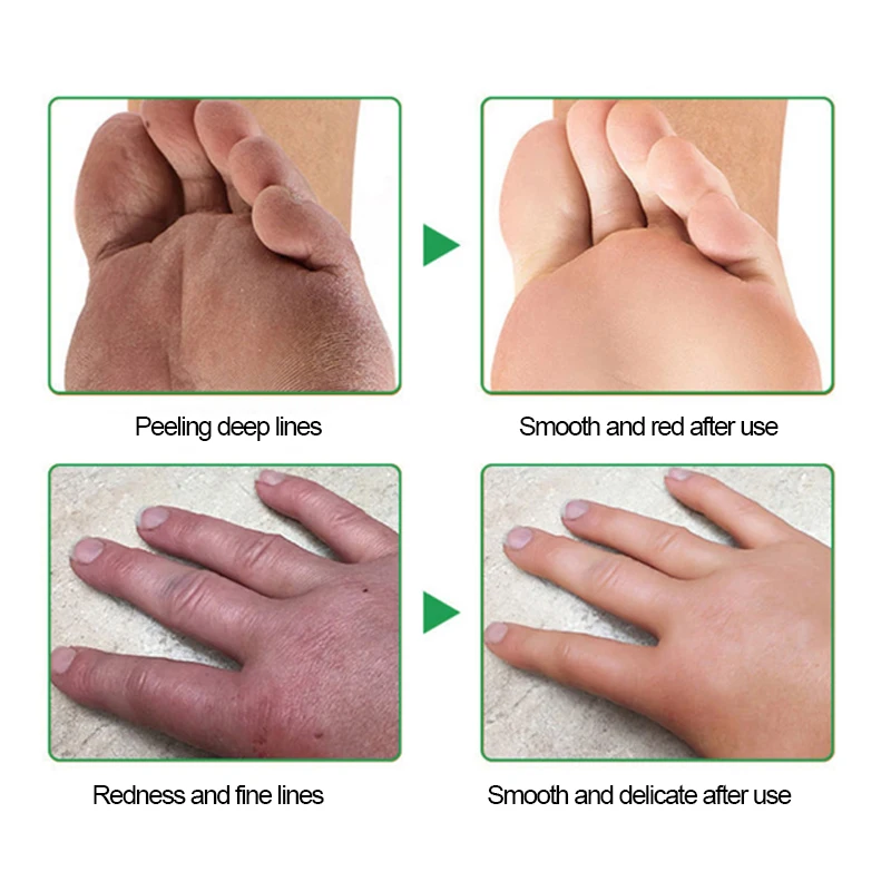 

20g/pcs Moisturizing Horse Oil Hand Cream Antibacterial Anti-Cracked Prevent Dry Skin Treatment Winter Moisturizing Ointment