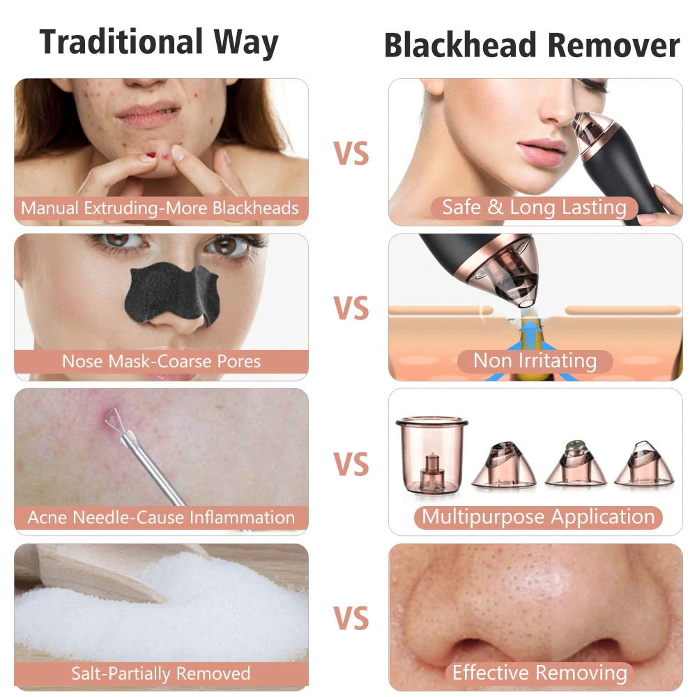 

Electric Blackhead Remover Machine Facial Pore Vacuum Cleaner Acne Pimple Suction Extractor 4 in 1 Body Guasha Cupping Massage