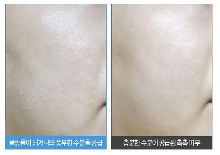 

Korea Cosmetic ELIZAVECCA Aqua Hyaluronic Acid Water Drop Cream 50ml Hyaluronate Acid High Moisture Cream Whitening Firm Care